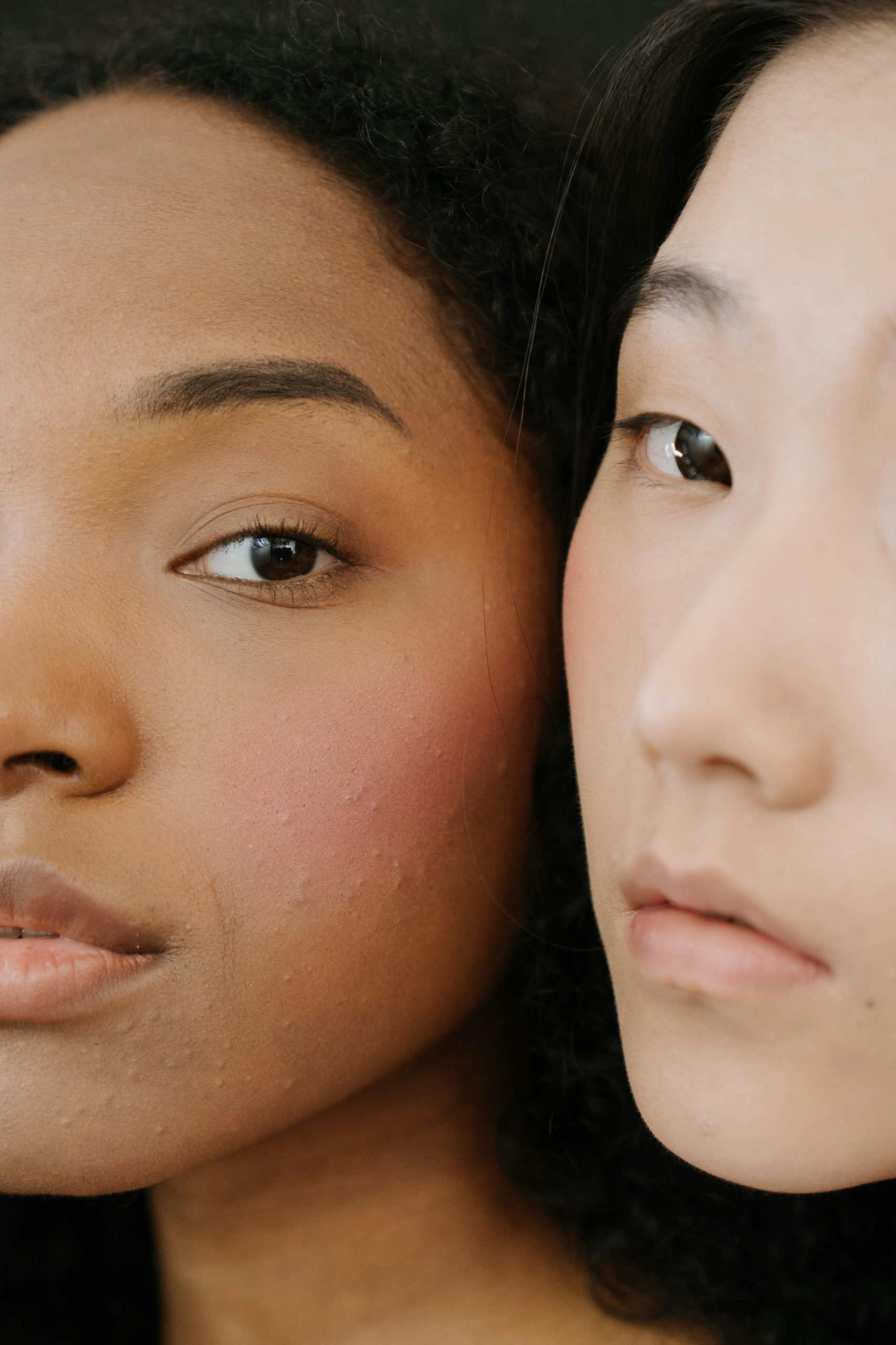 The Complete Acne Treatment Guide: Acne-Focused Skincare