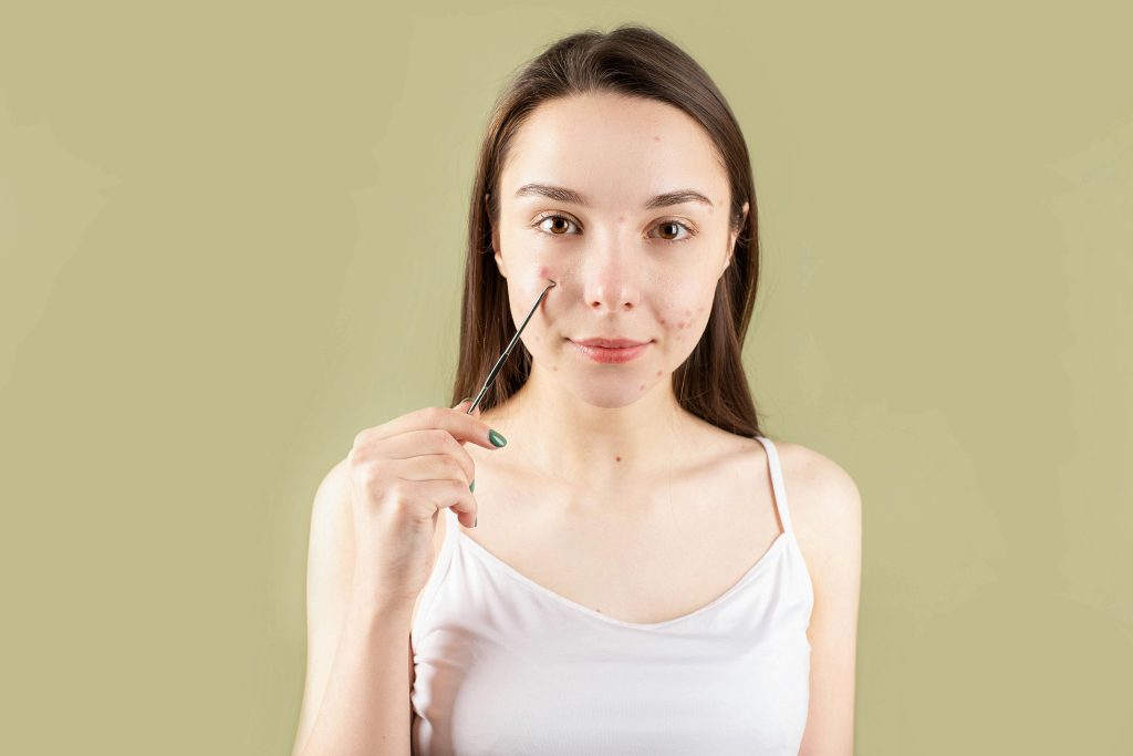 Best Acne Spot Treatments That Work Fast | Top 10 Picks for Clearer Skin